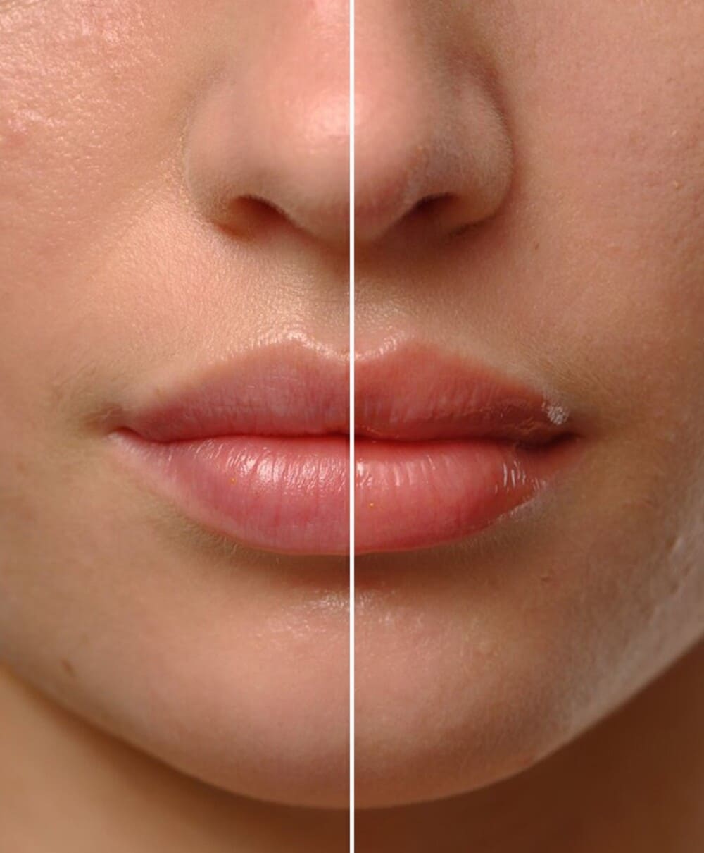 SUGAR TREAT LIP OIL (ACEITE LABIAL HIDRATANTE)